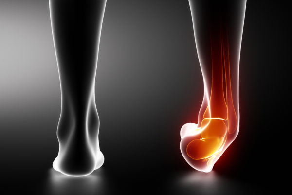 Ankle fracture surgery in Boise