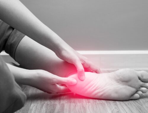 5 Clear Signs Your Plantar Fasciitis Is Healing