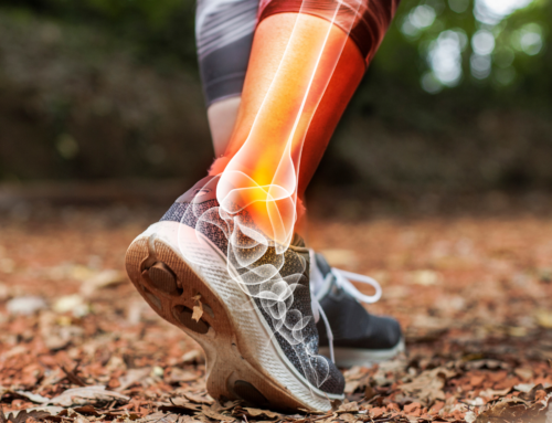 How Long After Ankle Replacement Surgery Can You Walk?