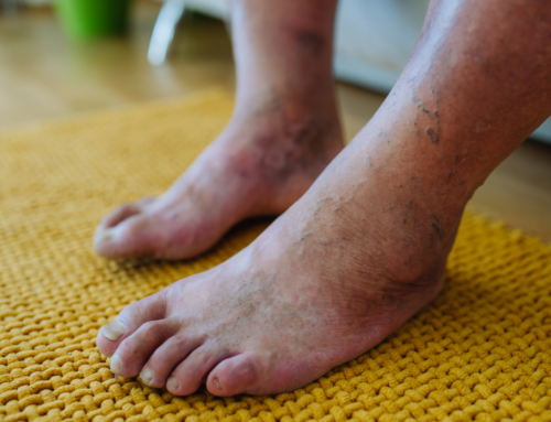 Diabetic Foot Care Tips Every Patient Should Know