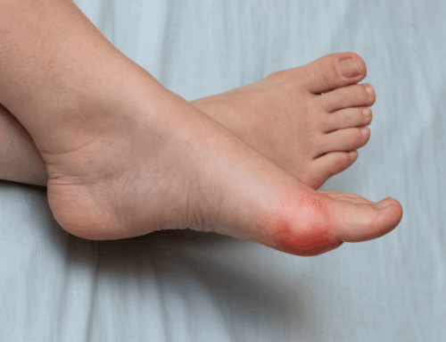 Footwear Fit & Support: General Tips to Help Reduce Everyday Foot Discomfort