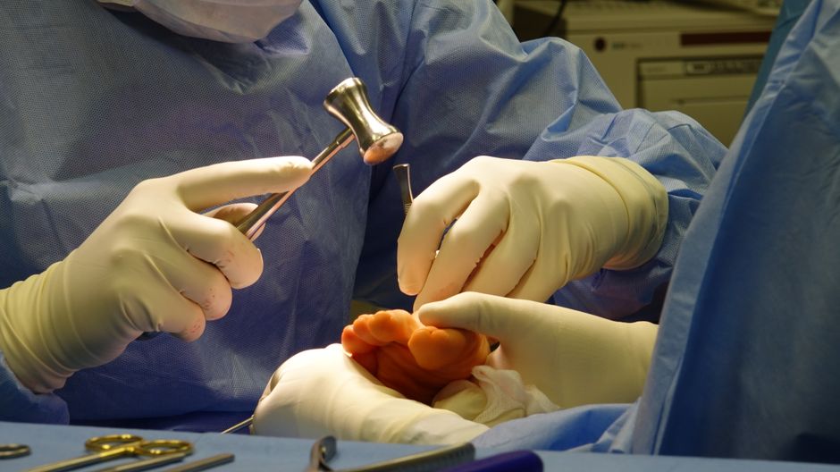 Surgical team performing a foot procedure, representing bunion surgery in Idaho